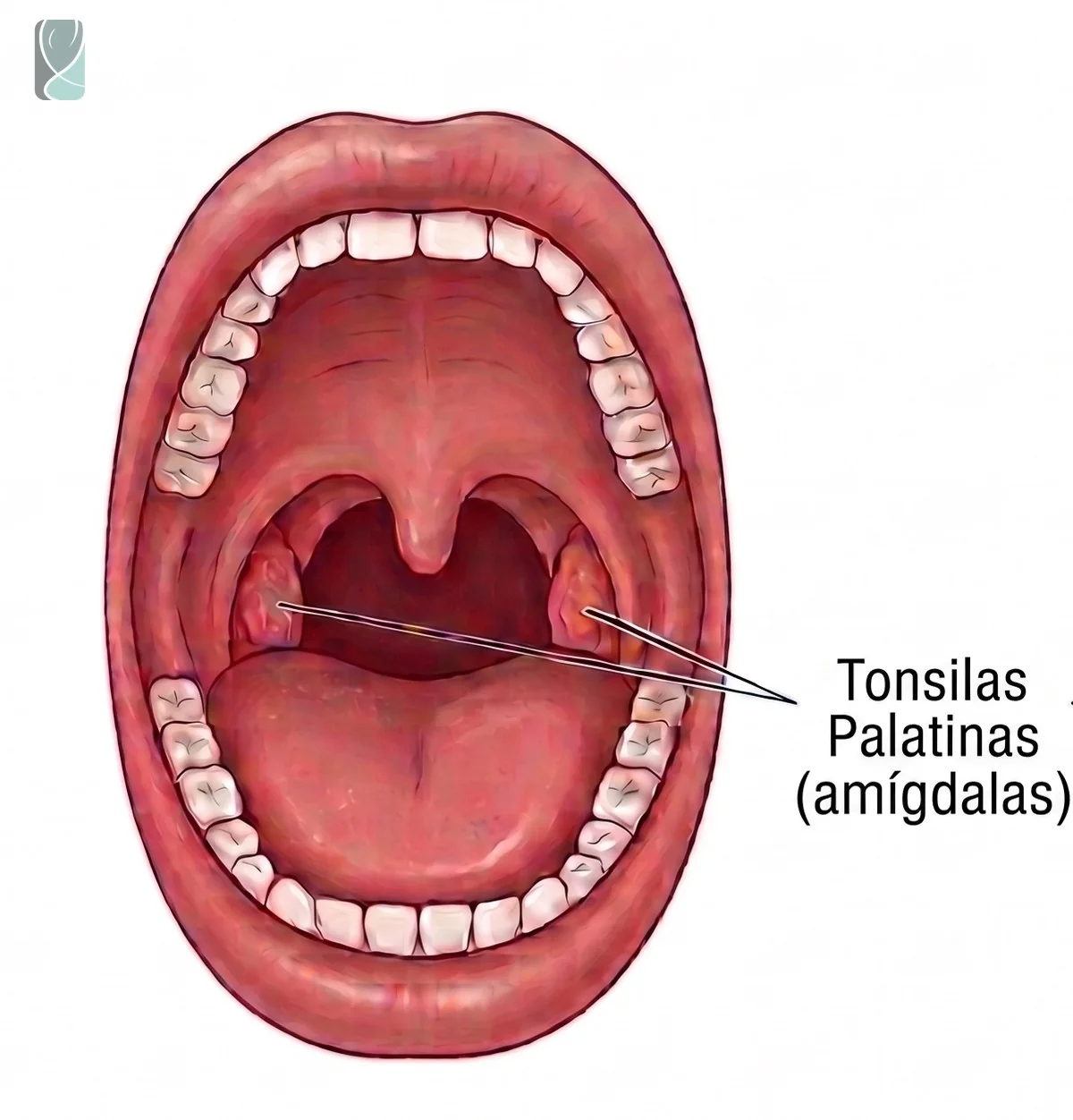 Ilustração das tonsilas palatinas (amígdalas) na cavidade oral