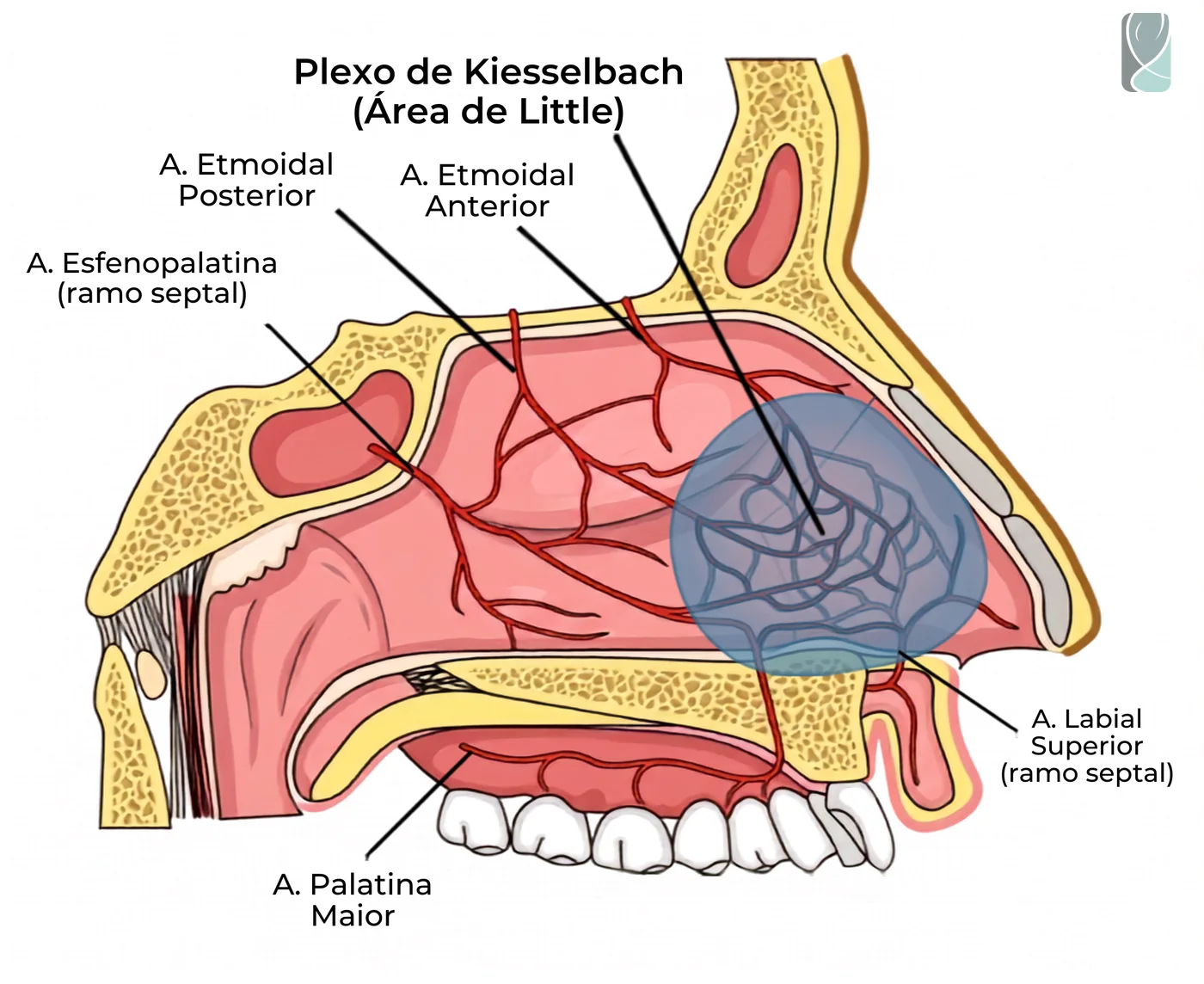 Ilustração anatômica da área de Kisselbach, região do septo nasal mais propensa a sangramentos